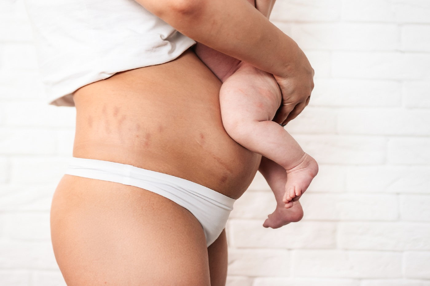 Postpartum Body Changes image picture