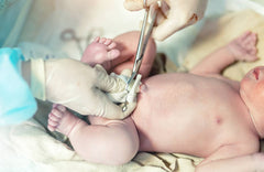 Delayed Cord Clamping: What Parents Should Know