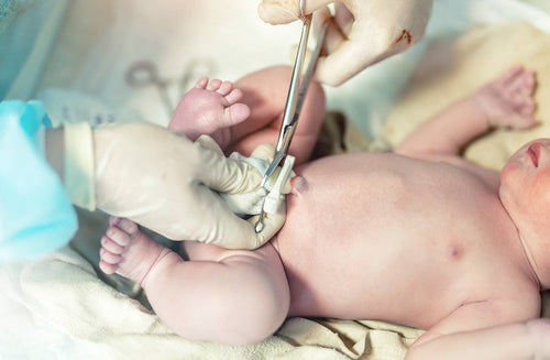 Delayed Cord Clamping: What Parents Should Know