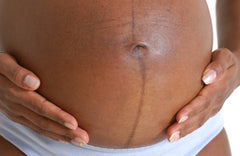 Linea Nigra During Pregnancy: What You Need to Know