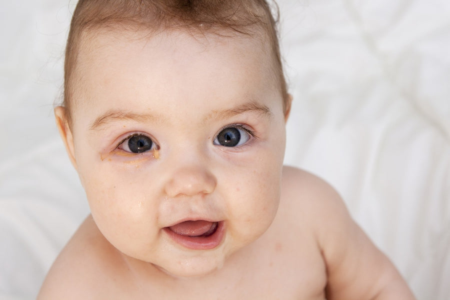 pink-eye-in-babies-and-toddlers-symptoms-and-treatment-happiest-baby